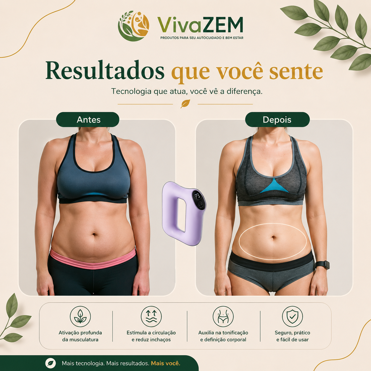SlimShape - Anel Massageador — imagem 5